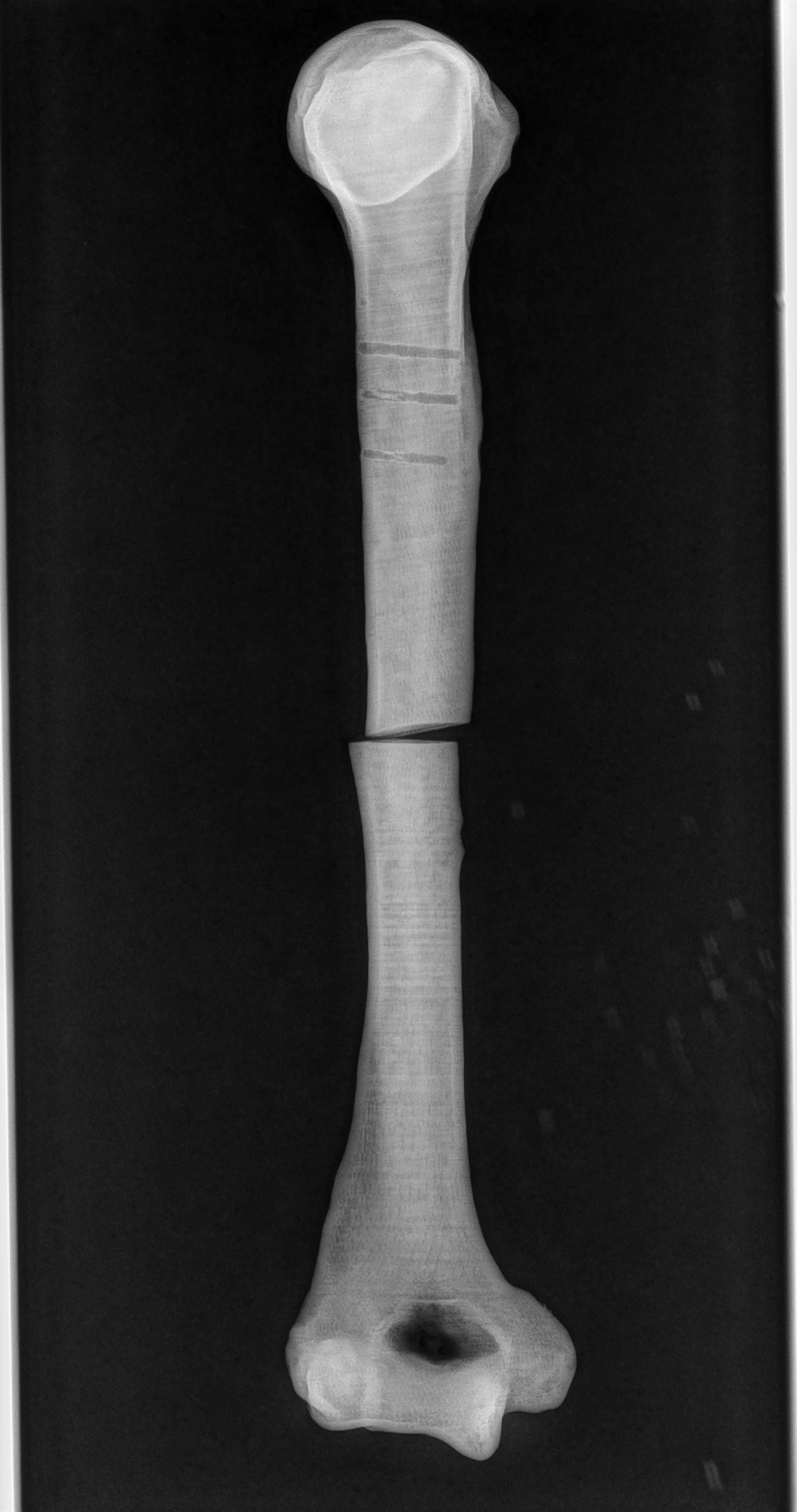 Radiograph of a humerus 3D-printed in 3DXTech SimuBone showing radio-opaque contrast on X-ray