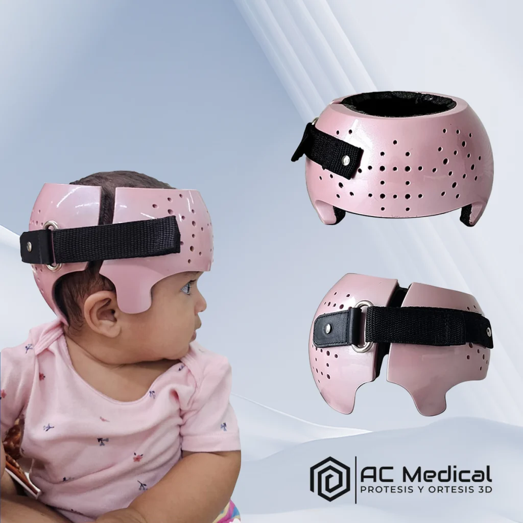 Full-color cranial orthotic helmet produced from an EinScan H2 scan, shown on an infant and from multiple angles