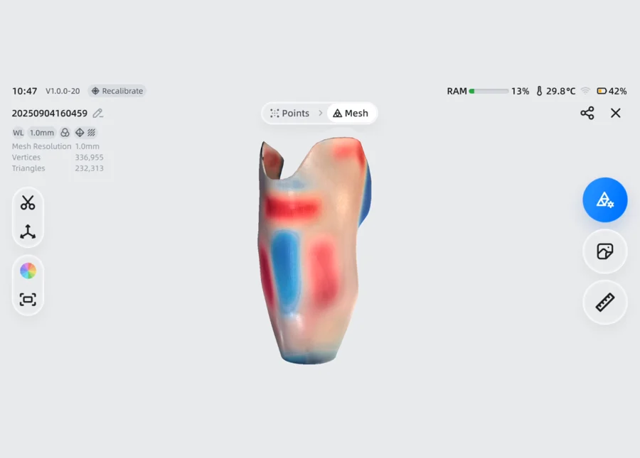 EinScan Medixa scanned prosthetic socket with pressure-zone heatmap output &mdash; clinical data ready for CAD/CAM design