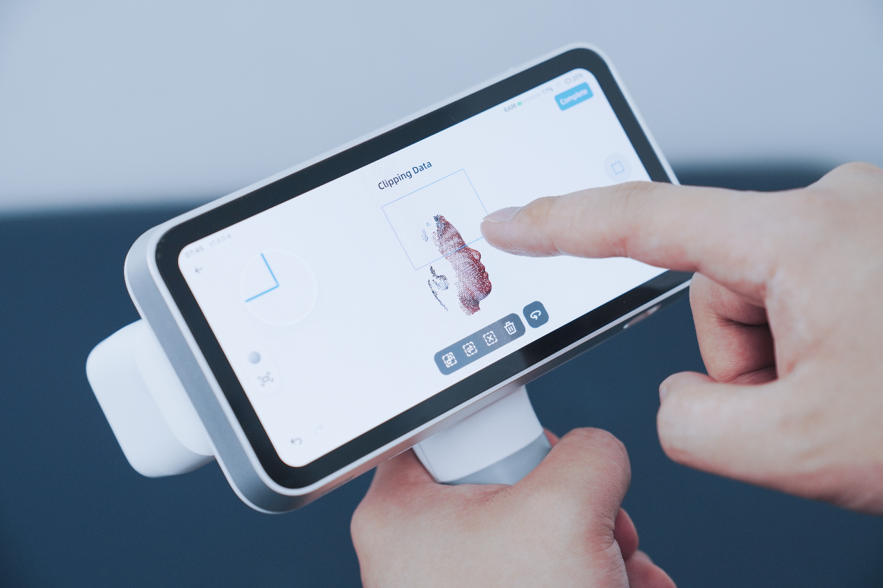 EinScan Medixa clinical application detail &mdash; capture workflow visualization for O&P practitioners