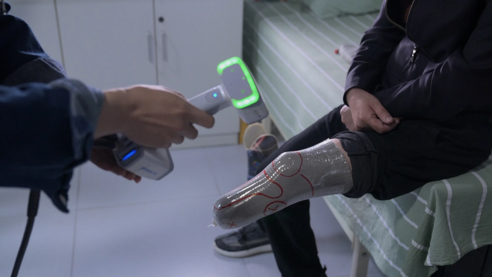 Clinician using a handheld EinScan O&P scanner to digitize a patient's marked residual limb in a clinic