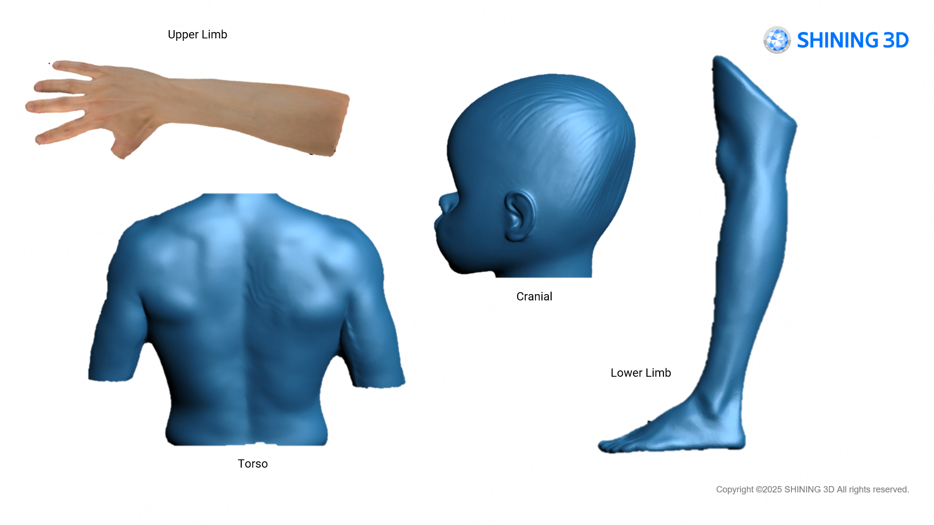 SHINING 3D EXScan O&P high-quality 3D scan results — upper limb, torso, cranial, and lower-limb meshes ready for export